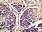 CSDE1 Polyclonal Antibody